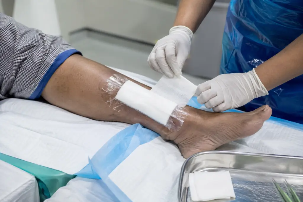 Advanced Wound Care Burn Wound Dressing Surgical Wound Care Diabetic Wound Care
