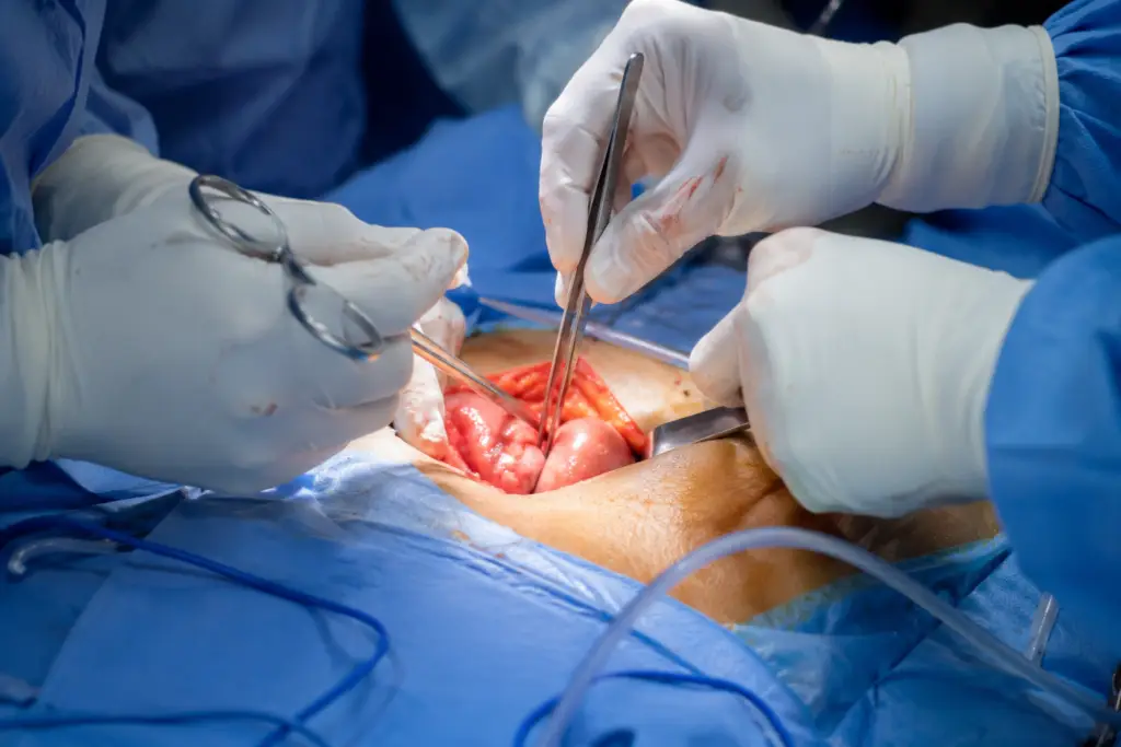Pediatric Hernia Surgery Child Hernia Treatment Pediatric Hernia Repair Hernia Surgery for Children Childhood Hernia Management