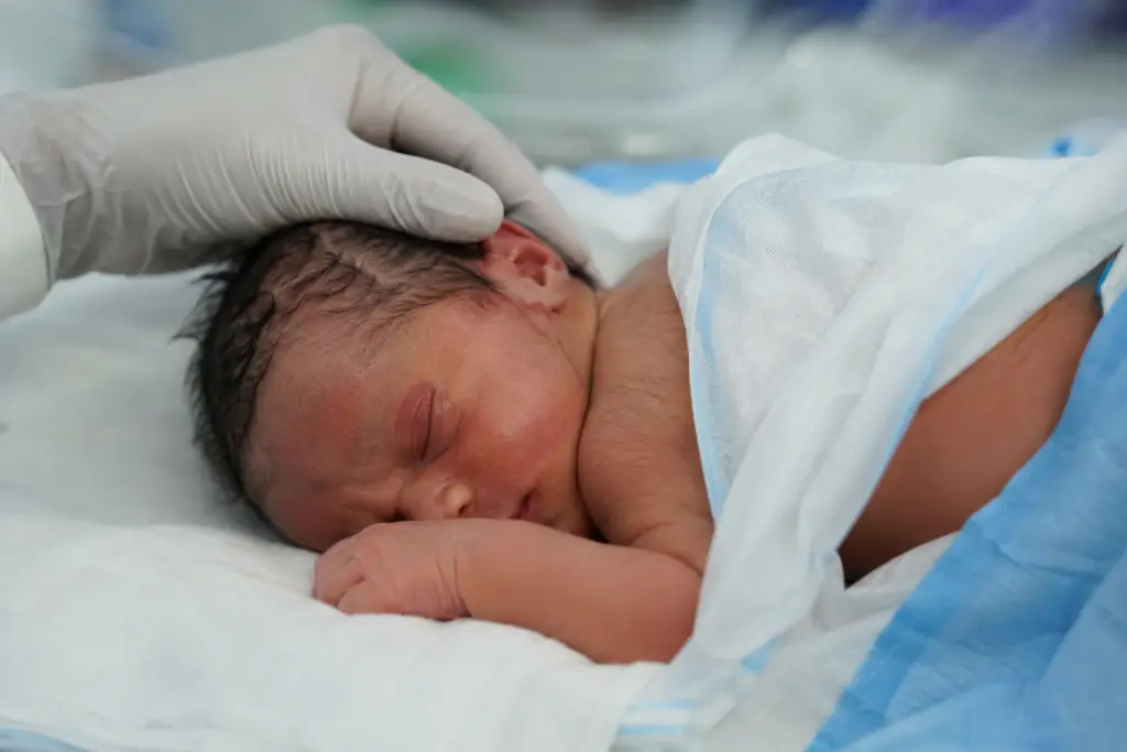 Jaundice & Infection Management Neonatal Jaundice Treatment Newborn Infection Management Neonatal Infection Care Jaundice Treatment for Newborns
