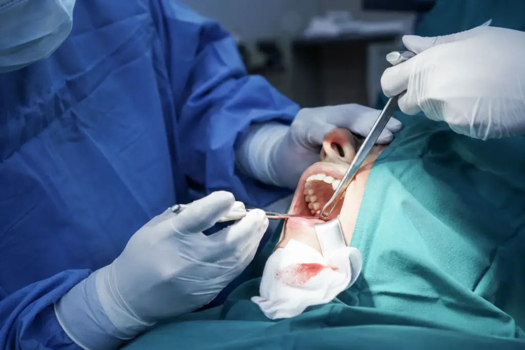 Tooth Extraction & Impacted Teeth Surgery Impacted Tooth Removal Tooth Extraction Surgery Wisdom Tooth Extraction Surgical Tooth Extraction